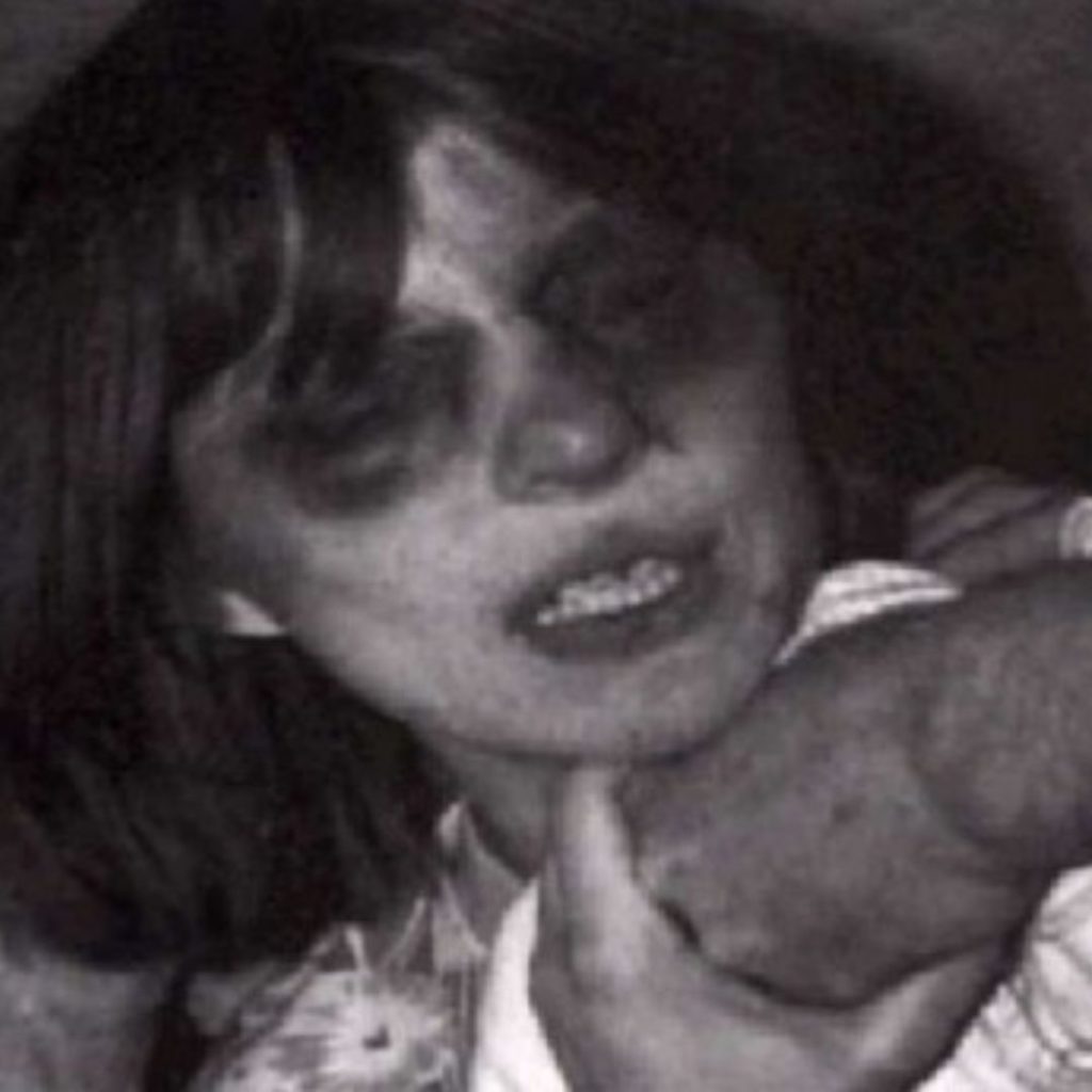 Anneliese Michael shortly before her death after exorcism photograph.